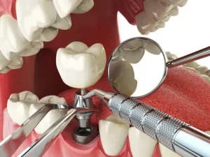 Online Dental Supply