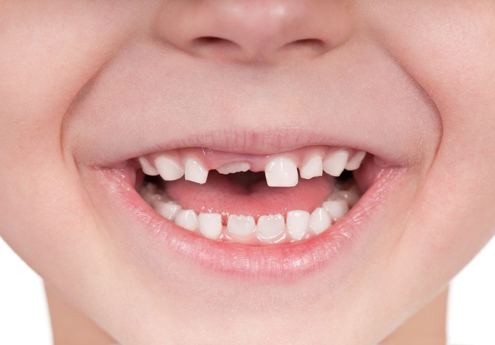 Children's Dentists In Caringbah