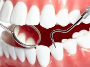 i (1)