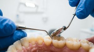 dentist preston