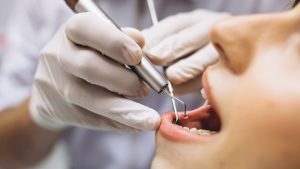 dental implants western sydney