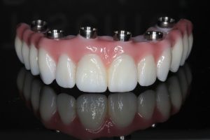 c4e6e5bfad5edc0665449df292a1b15c (1)